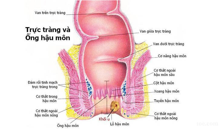 Ung thư hậu môn trực tràng là bệnh gì?